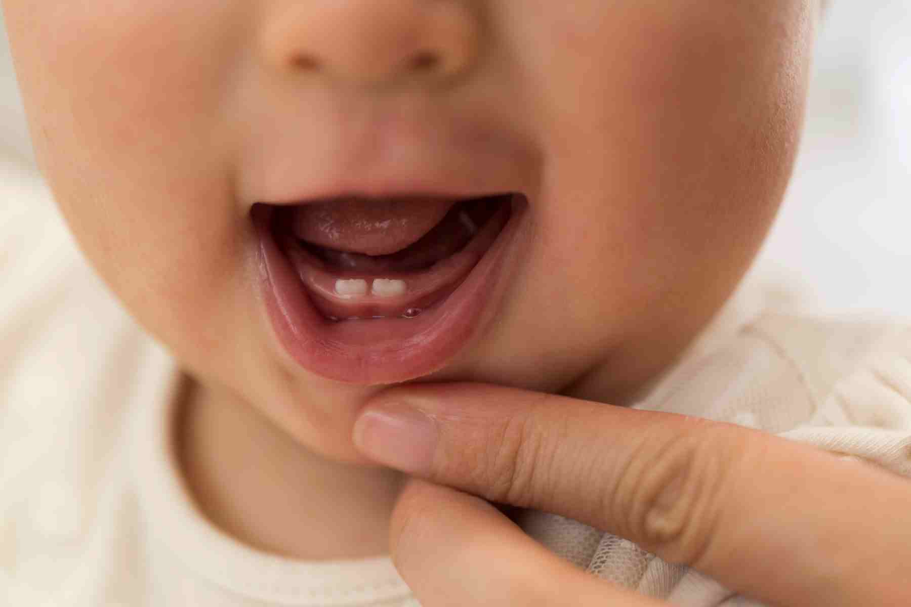 teething fever
